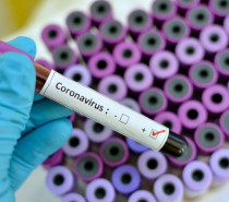 Brasil tem 234 casos confirmados de novo coronavírus, diz o Ministério da Saúde